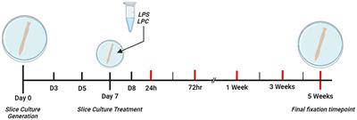 Modeling demyelination and endogenous remyelination in spinal cord ex vivo rat organotypic slice cultures